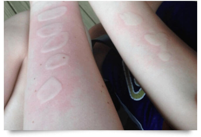 the salt and ice challenge