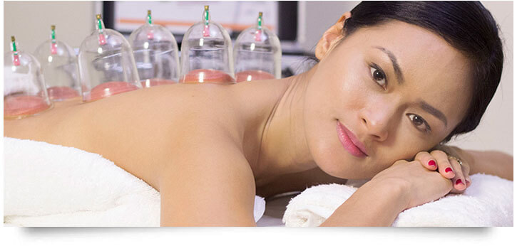 cupping