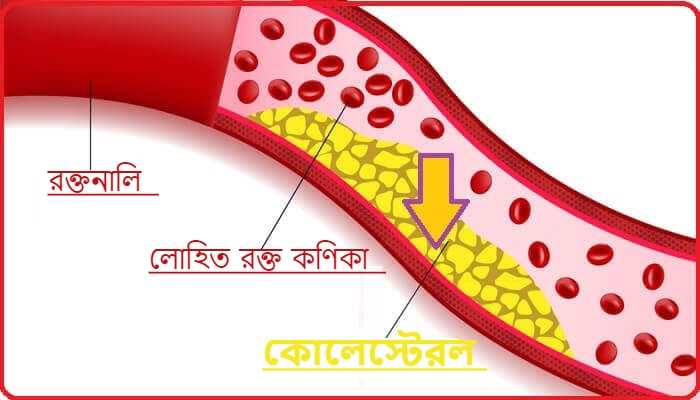 রক্তে অতিরিক্ত কোলেস্টেরল